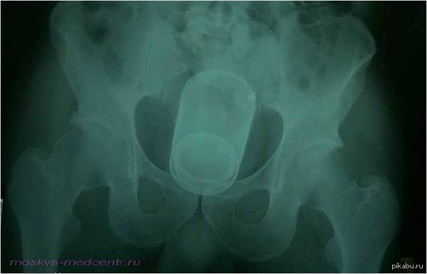 ��� ���, ������! (���� ����� ���������� ���� ������ - ������ ���������� ������� ���������� ����. ������� ��-�� ���� ������������))