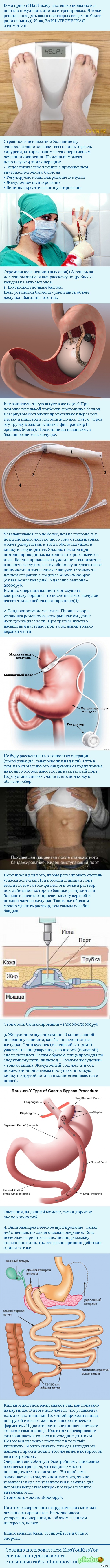 ����� - ��� �������
