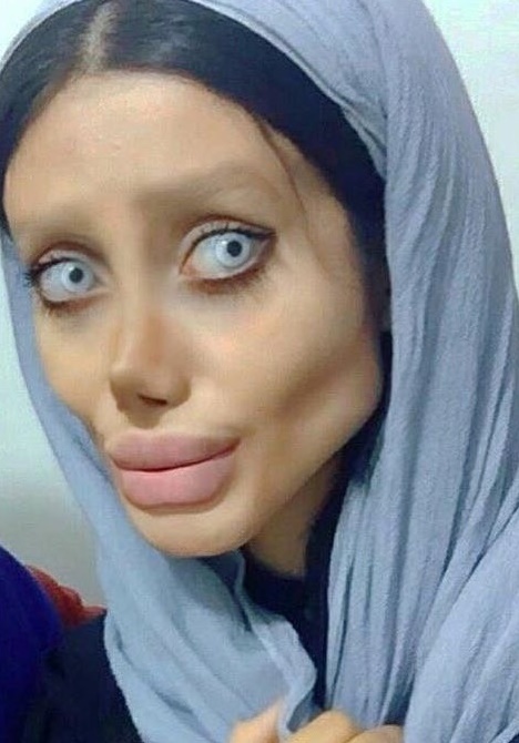 Iranian woman undergoes 50 surgeries to look like Angelina Jolie - Plastic, Angelina Jolie, Horror, Nightmare, Longpost