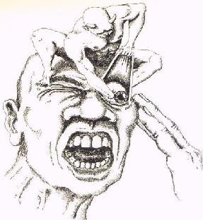 Cluster Headache. - My, Headache, 