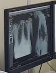 When asked to take a photo for the site - Tomograph, CT, X-ray, Hospital, , Longpost