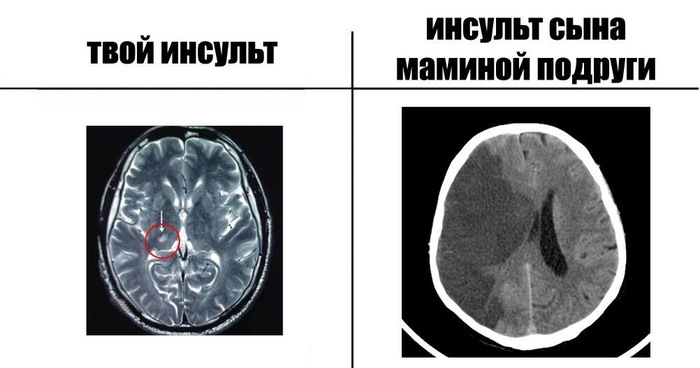 Инсульт - Инсульт, Сын, Сын маминой подруги