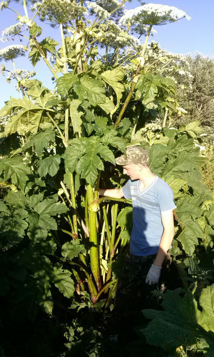 Already in intensive care, we learned that it was not rhubarb. - Hogweed, Rhubarb, Bad luck, Burn, Tourism, Cruel world