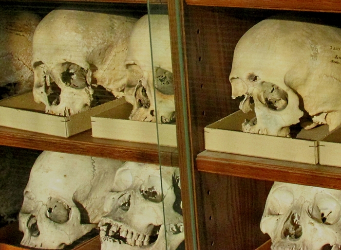 Collection - My, Scull, Anthropology, Collection, Museum, Vein, Longpost