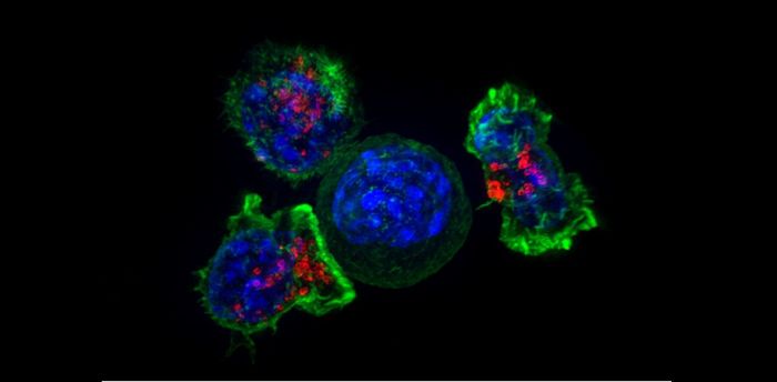 Trained immune killer cells saved a patient with terminal breast cancer - Cancer Immunotherapy, Breast cancer, Immunity, t-Lymphocytes, , Longpost