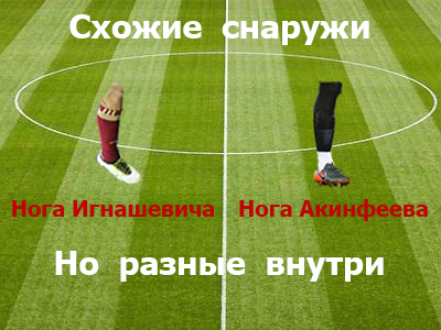 Leg Akinfeev - My, Soccer World Cup, Football, Football fans, Russian national football team, Leg Akinfeev