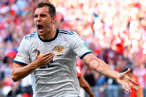 Scandal: Dzyuba has a distinct injection mark - My, Football, Artem Dzyuba, , World championship, World Cup 2018, 2018 FIFA World Cup, Doping