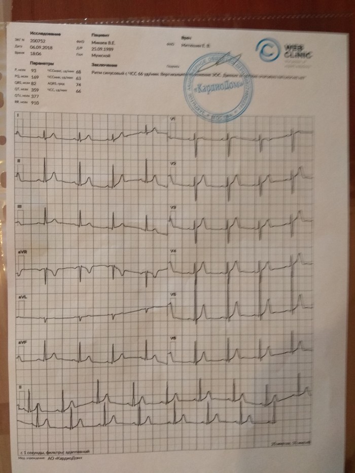 Question for doctors. - My, No rating, ECG, Help, The medicine