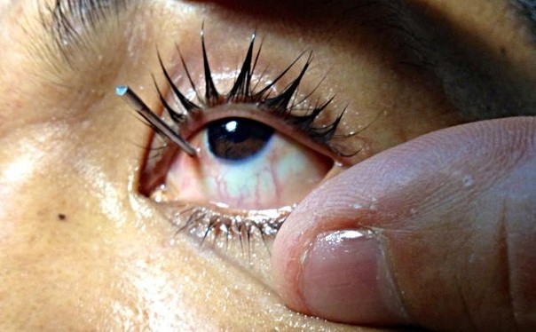 7 основных видов травм глаз и их лечение