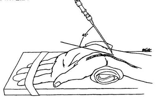 Space technology at 23 hospitals or Forbes learned about radial access - Leonid Roshal, X-ray surgery, , Technologies