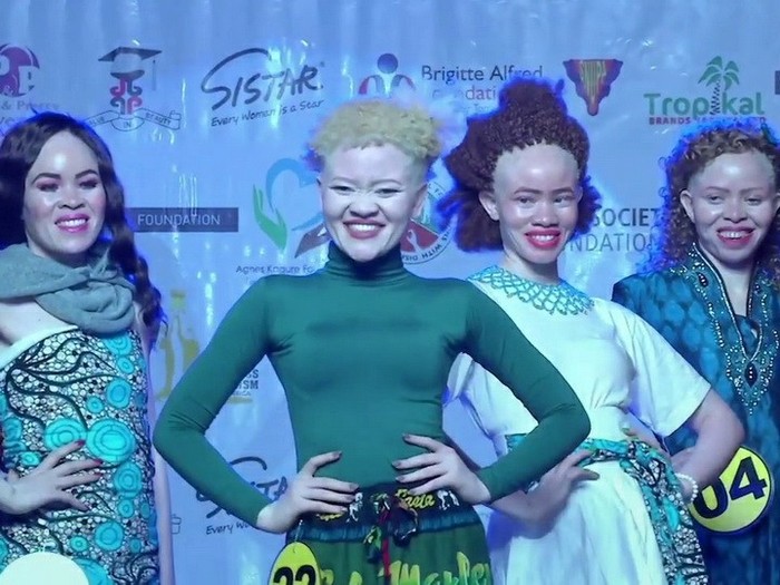The most beautiful albinos in Africa - Beauty contest, Africa, Albino, , beauty, Ritual, Interesting, Longpost, Video