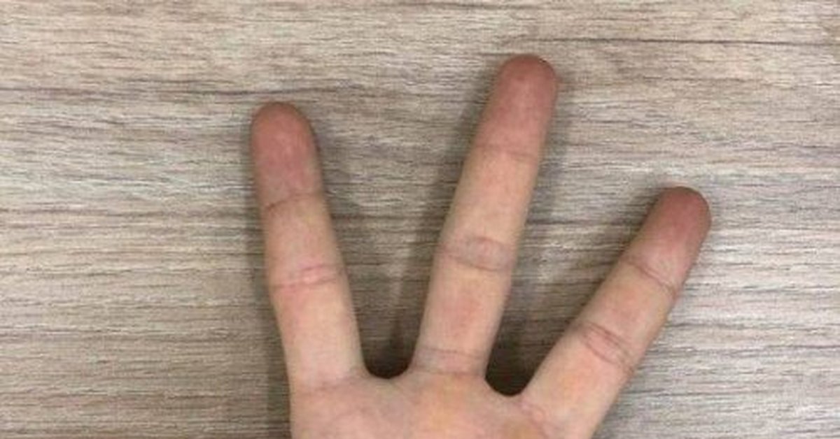 Четыре пальца на руке