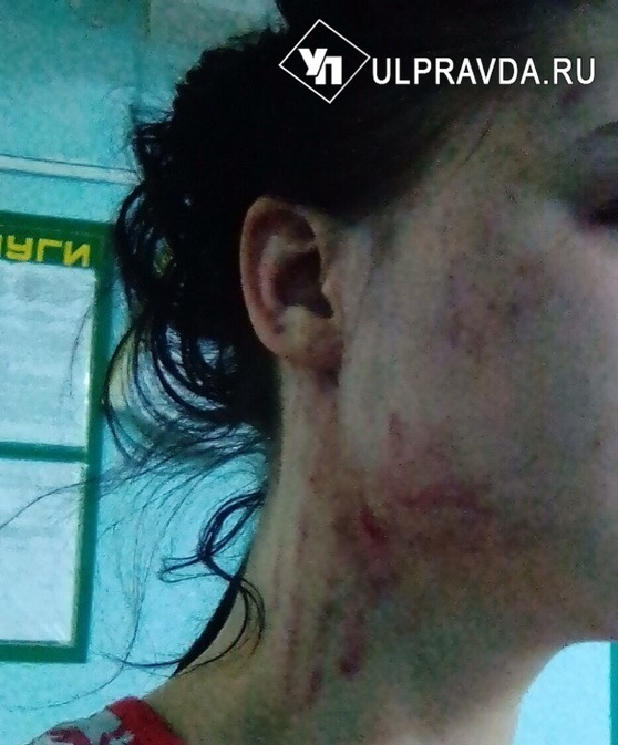 In the Central Clinical Hospital, a doctor beat a patient during an operation! - Ulyanovsk, Ulyanovsk region, news, Negative, The patients, Help, Lawlessness