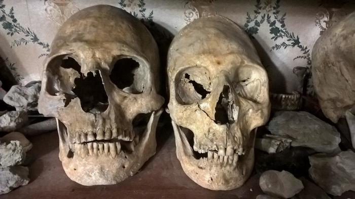 Unusual skulls of the Sarmatian aristocracy - Archeology, My, Sarmatians