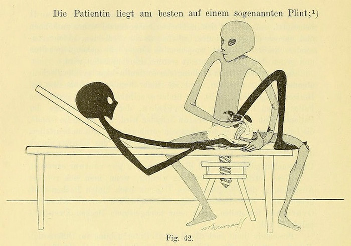 Gynecological gymnastics with humanoid aliens from an 1895 book - Longpost, Gynecology, Gymnastics, Intimate gymnastics, Humanoid, Aliens