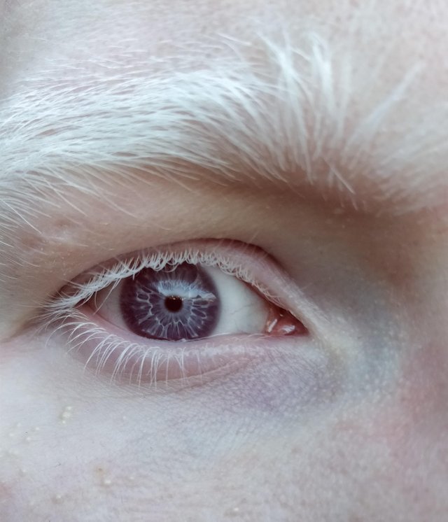 purple eyes - Eyes, Purple, White hair, Albino, beauty, Brows, Eyelashes