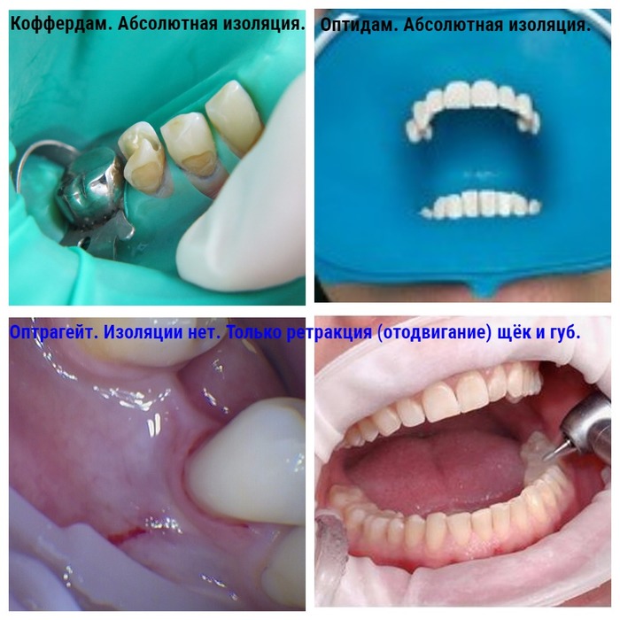Как оценить качество лечения зубов thumbnail