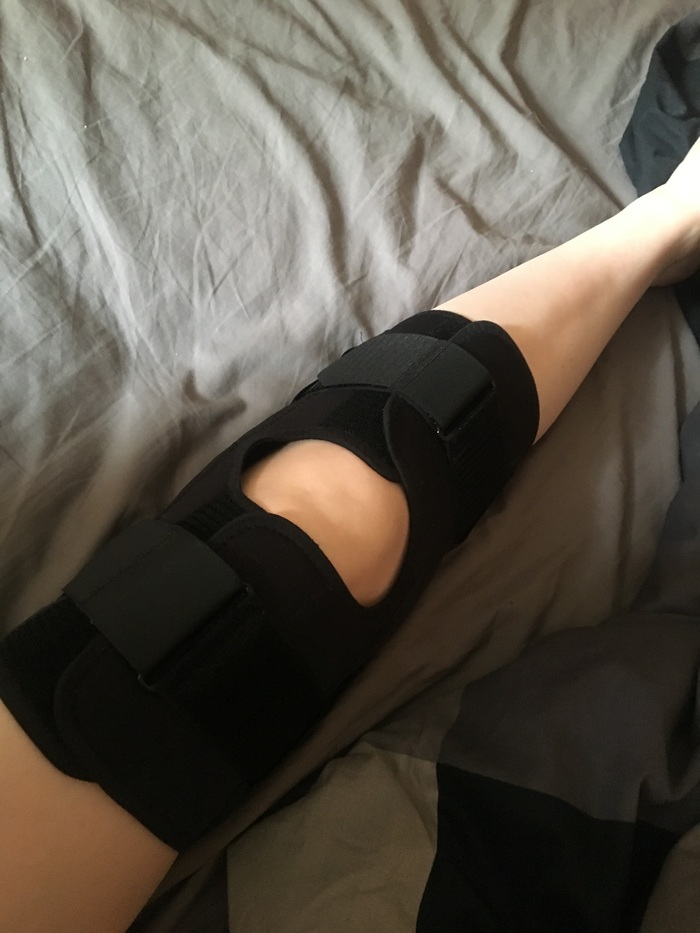 meniscus injury - My, Injury, Meniscus, Knee, Health, Legs, So it goes, Longpost