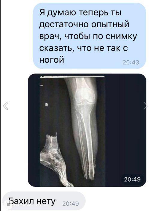 The most important thing - Screenshot, Correspondence, X-ray