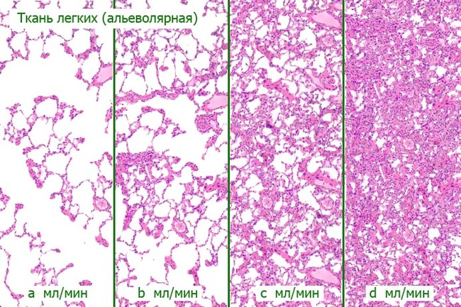 What You Probably Haven't Been Told About Cancer - Disease, Health, Vitamins, Longpost