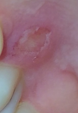 Help. What's this? - My, Teeth, Dentist, Palate, Gum, Self-medication, Help