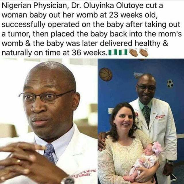 Nigerian doctor - Doctors, Tumor, Operation, , USA, Surgery, Picture with text, Teratoma