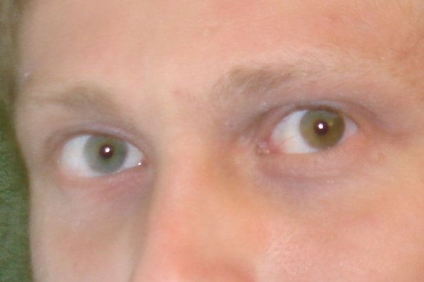 About genetic mutations - Mutation, Heterochromia, The photo, Interesting