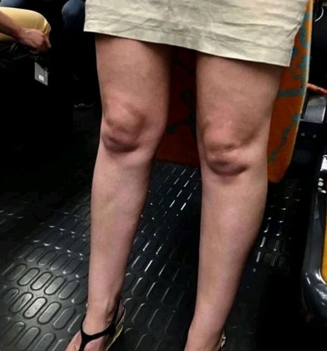 Twins - Legs, Girls, Kripota, Pareidolia, Face, Knee