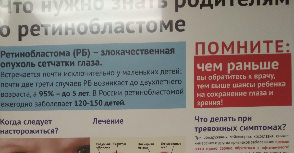 Ретинобластома. Что нужно знать родителям. | Пикабу