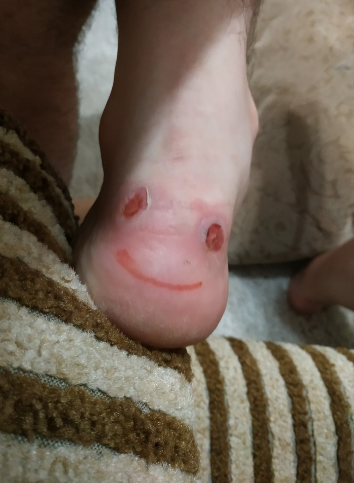 Когда скрываешь свою боль