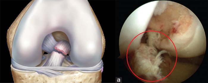 Arthroscopy - My, The medicine, Medicine in Russia, Longpost, Arthroscopy