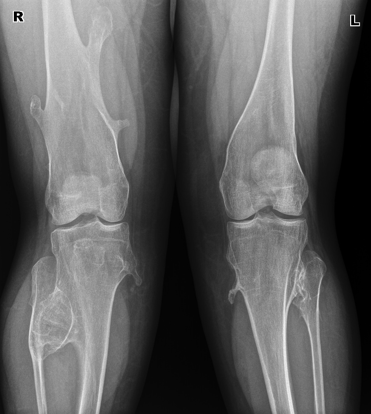 From the life of a radiologist. Part 5 - My, X-ray, The medicine, Fracture, Crack, Longpost