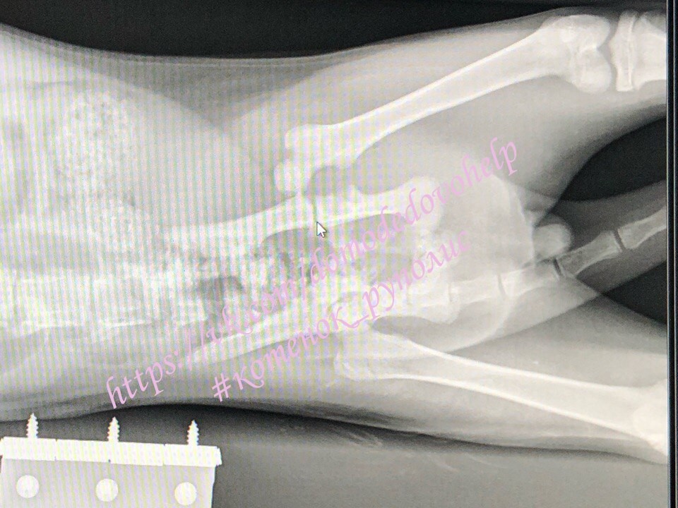 Help a cat with a fracture and a burn.. - , cat, , Good league, Volunteering, Domodedovo, Help, Fracture, Longpost