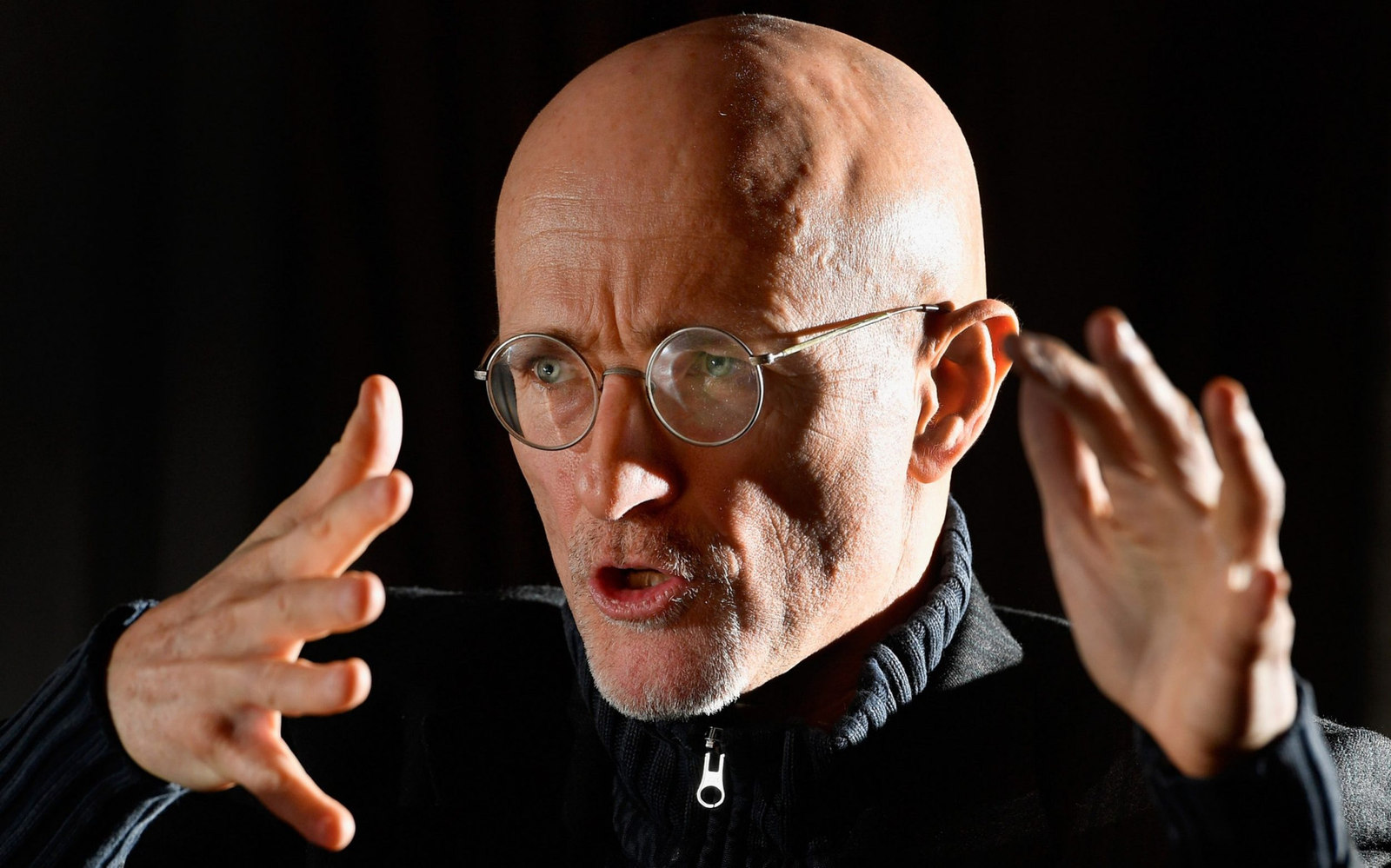 World's first head transplant performed - The medicine, The science