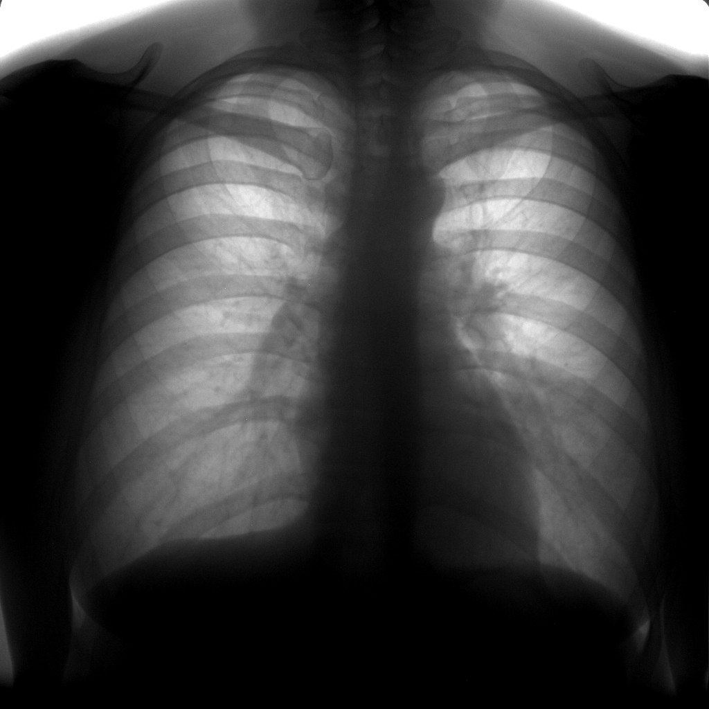 From the life of a radiologist. Part 6 - My, X-ray, X-rays, The medicine, Longpost