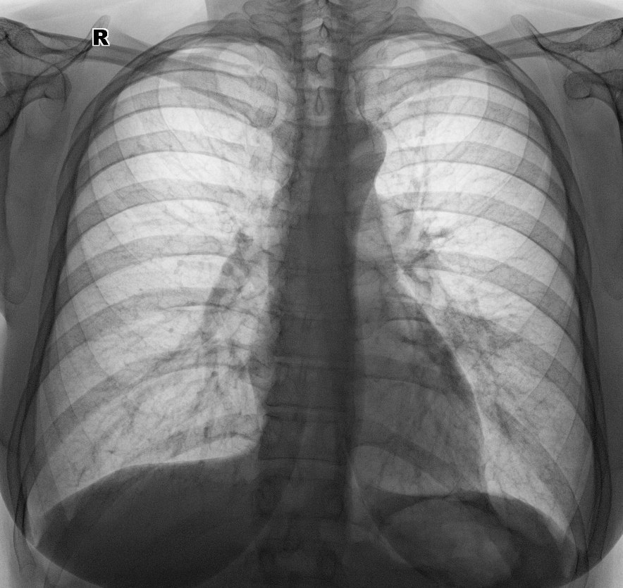 From the life of a radiologist. Part 6 - My, X-ray, X-rays, The medicine, Longpost