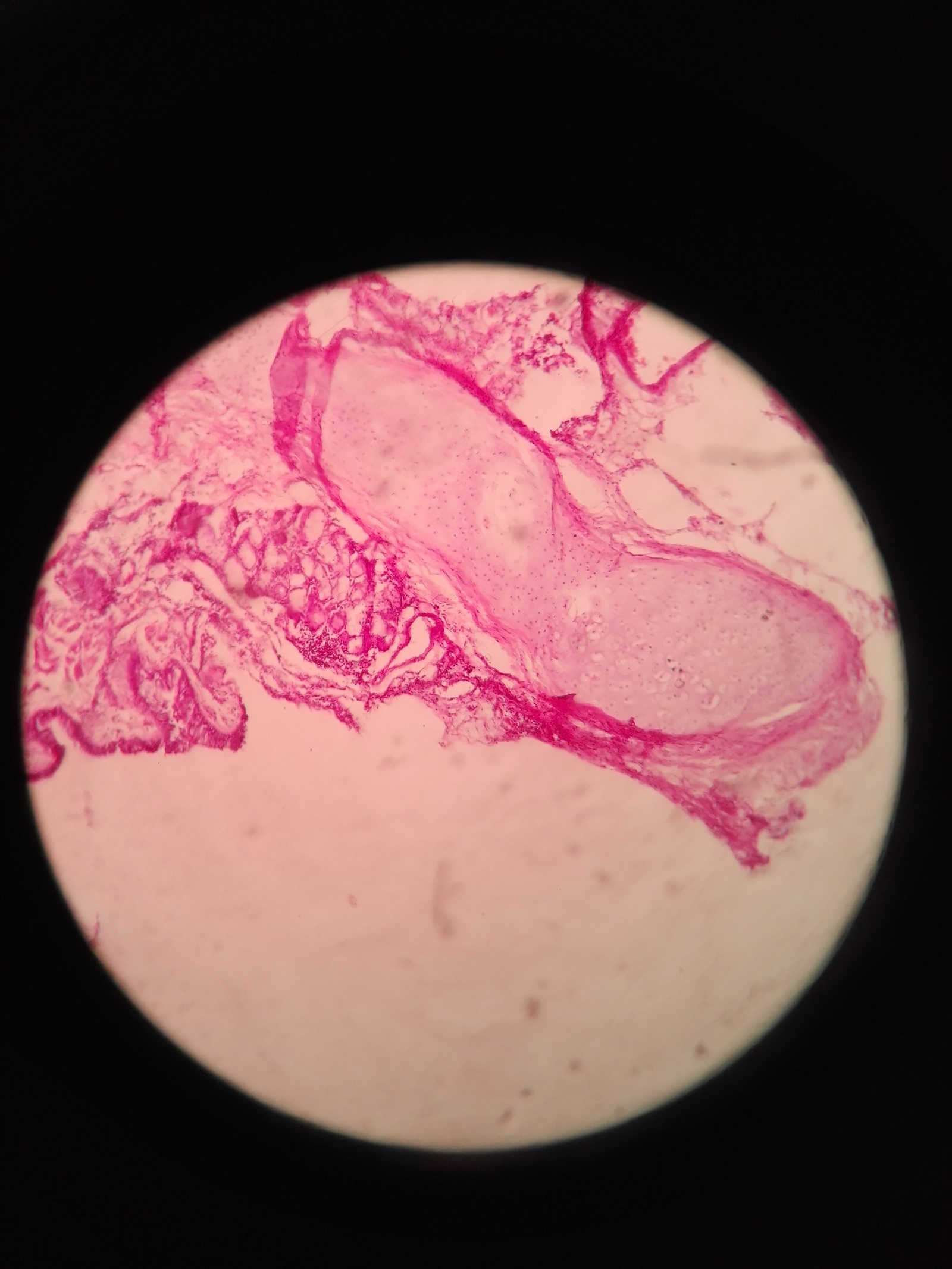 There are no macropreparations, but you hold on - My, The medicine, Oncology, Histology, Pathological anatomy, Longpost