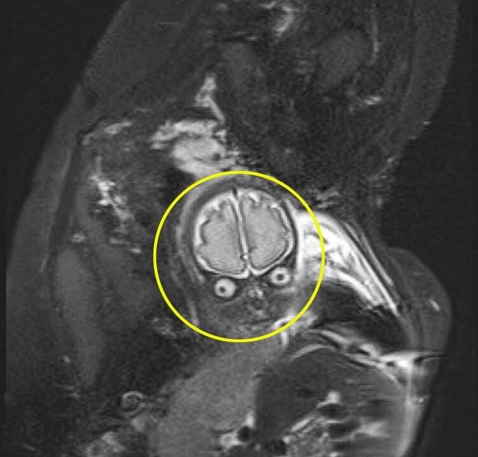 MRI scan by Tim Burton ;) - England, MRI, Mars, Longpost