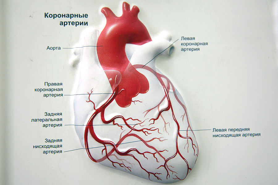 Risk factors for developing coronary artery disease or Yes, my genes are bad! - Ihd, , The medicine, Cardiology, Excess weight, Smoking, Alcoholism, Longpost, Risk