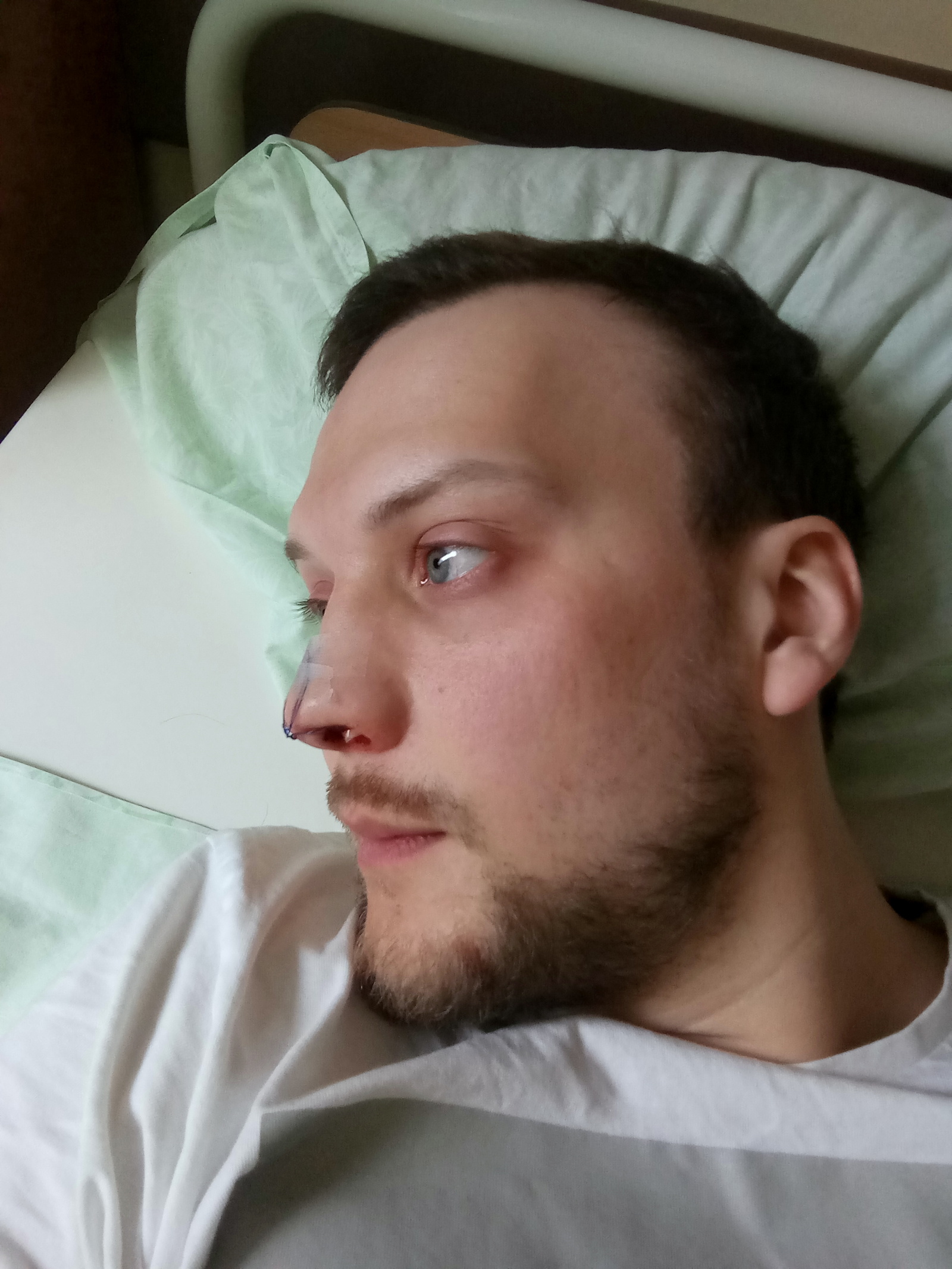 Искривление носовой перегородки: лечение в Санкт-Петербурге