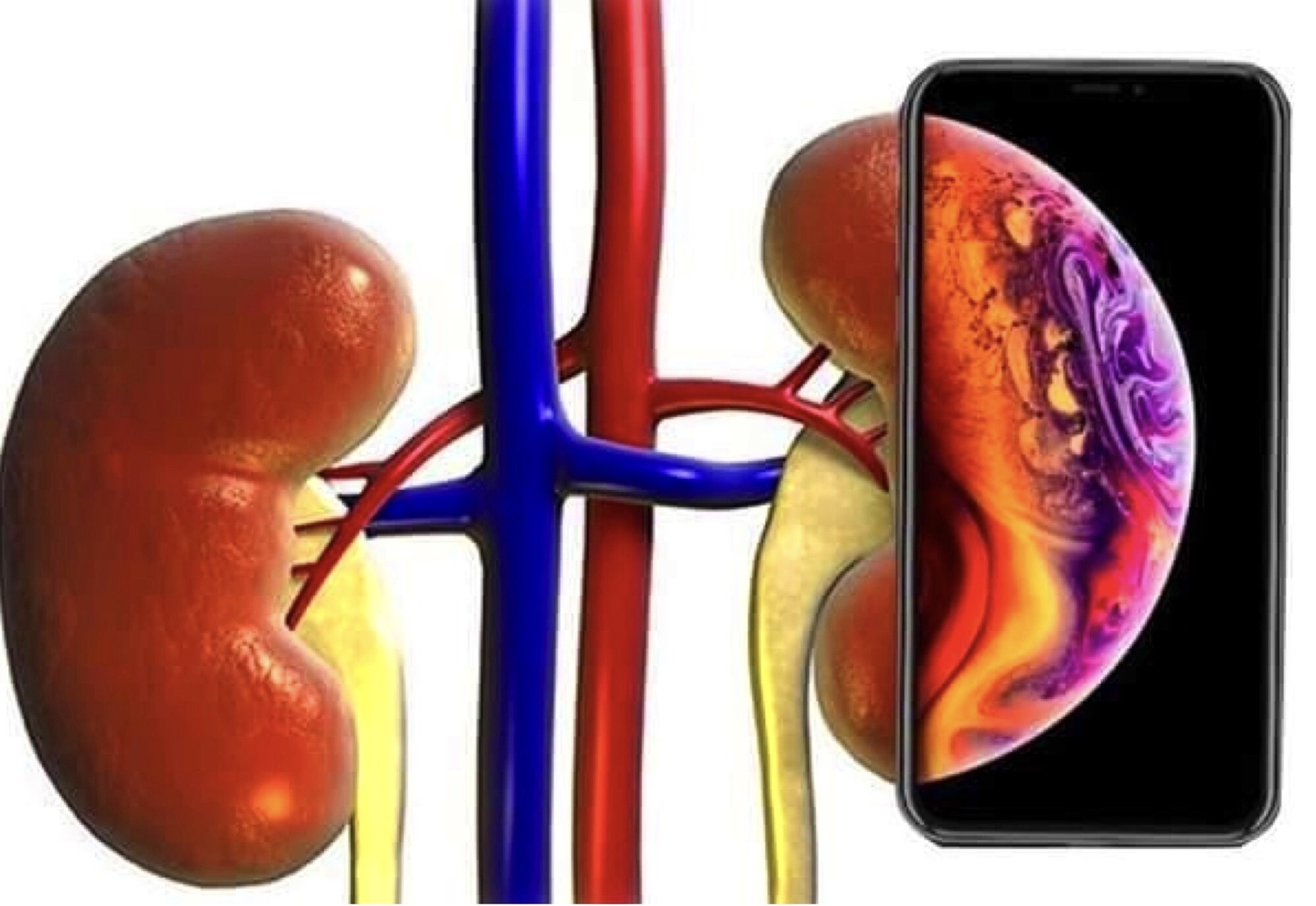 The new IPhone screensaver hints at you to sell your kidney and buy a smartphone with it - Apple, Steve Jobs, Hint, Humor, Kidney