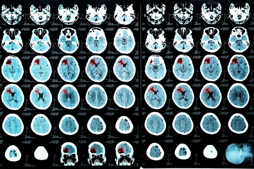 How to invest in science? Give scientists brains, hands, eyes and money! - How?, , Myself, The science, , Calculations, Longpost, Tag