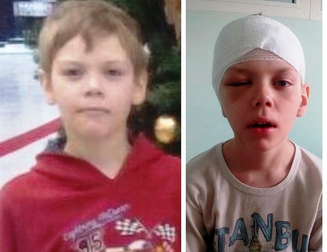 Мальчик после. Мальчик после операции. Мальчик с разбитым лбом.