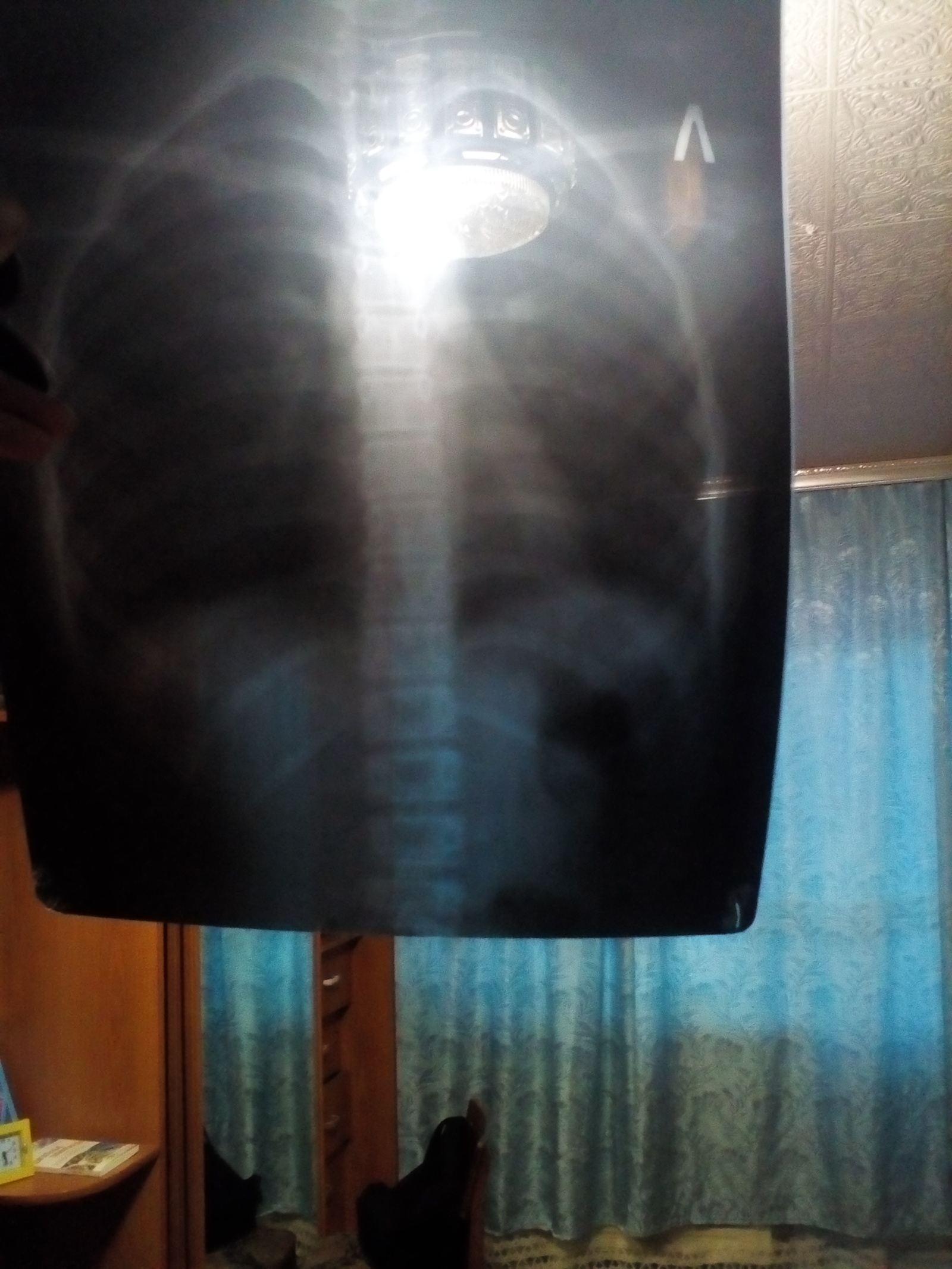 Peekaboo, please help, I'm at a loss - My, X-ray, Help, No rating, Doctors, Doctors need help, Longpost