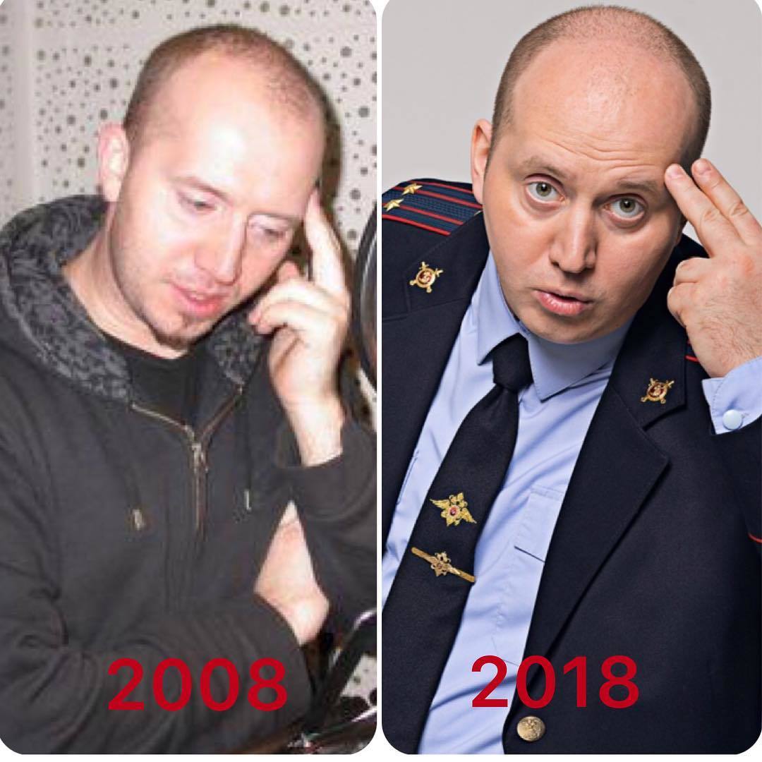 Sergey Burunov - 10yearschallenge, Sergey Burunov