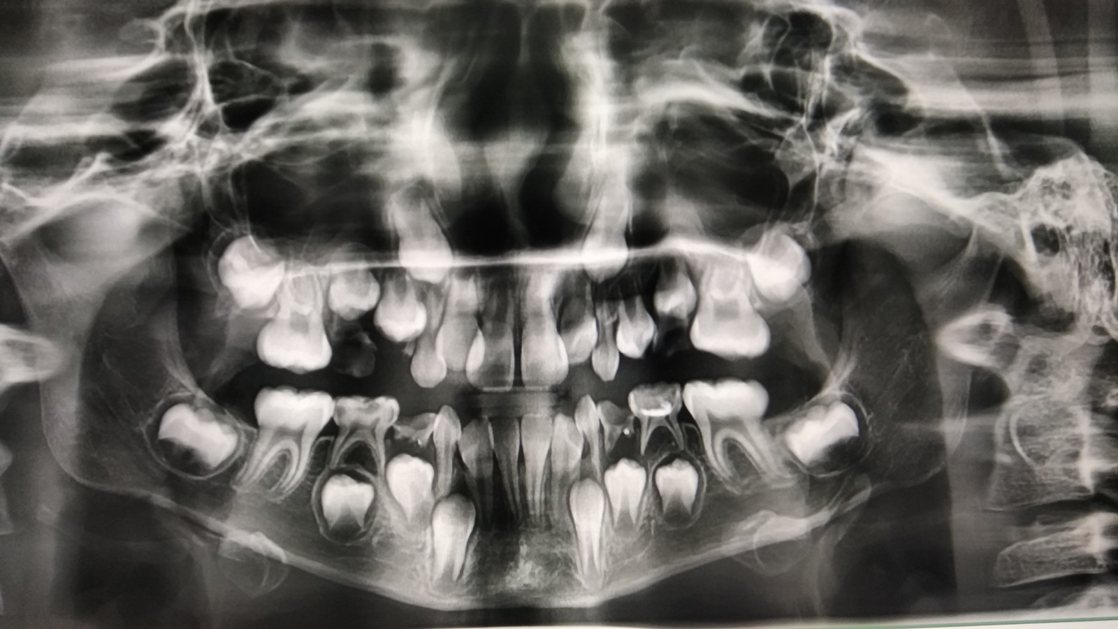Снимок зуба Томск Инженерный стоматология томск цены и отзывы