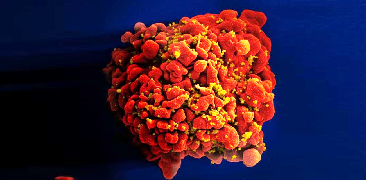 They waited a long time: the world's second patient with HIV infection was cured by a bone marrow transplant - , Bone marrow transplantation, , Longpost, Marrow