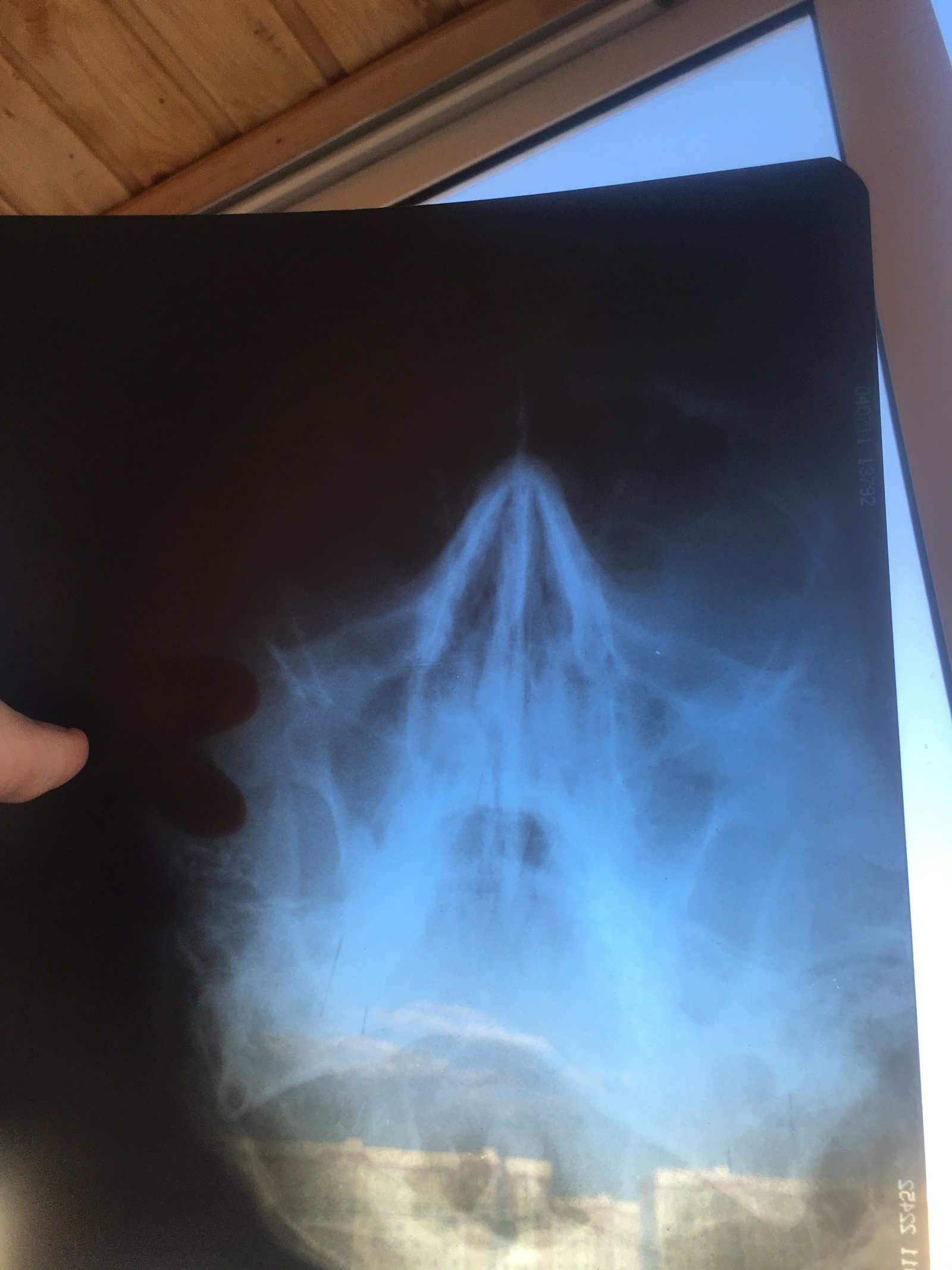 Doctors need advice! - X-ray, Doctors need help, Longpost