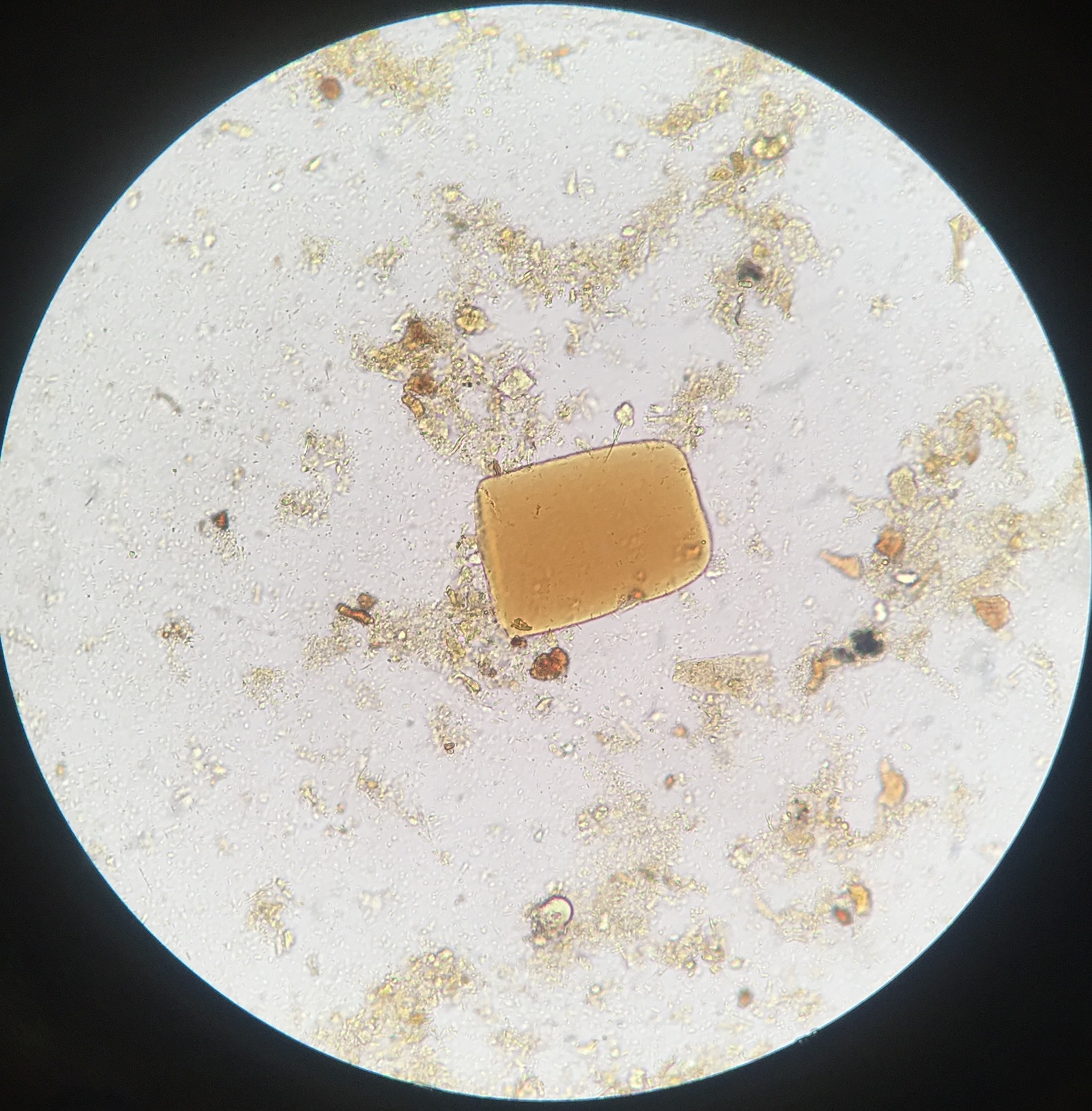 Жирные кислоты в большом количестве в кале. Микроскопия кала детрит. Микроскопия желчи под микроскопом. Копрология кала микроскопия. Пробки Дитриха микроскопия.