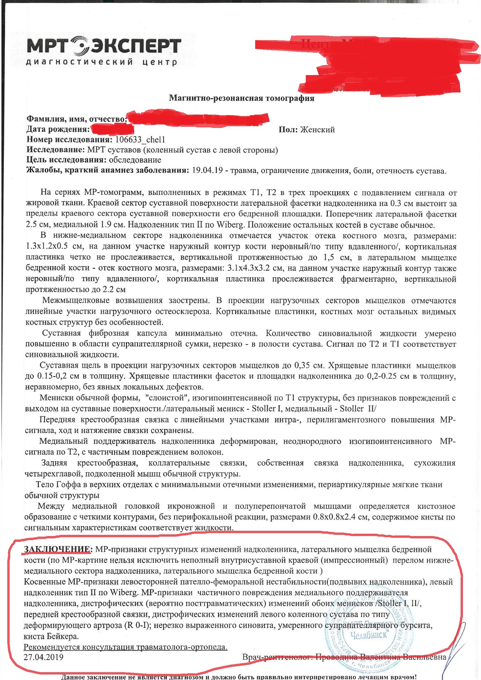 История о том,как чокнутой мамашке ремонтировали колено - Моё, Травма, Колено, Операция, Страх, Длиннопост